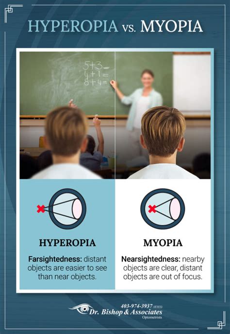 mypoea|myopia vs hyperopia.